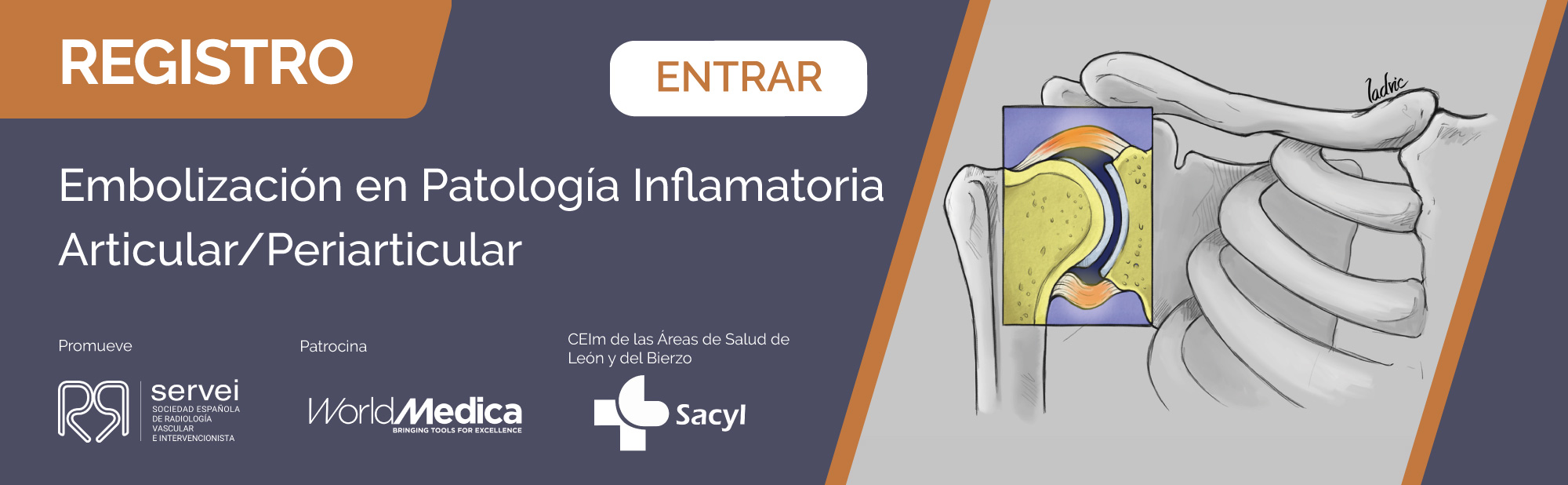 Registro Hombro Congelado