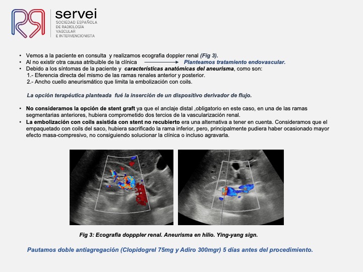 Aneurisma renal con dispositivo derivador flujo 05