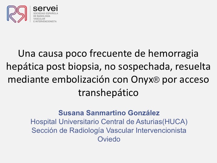 01 Hemorragia hepatica postbiopsia-embolizacion con Onyx